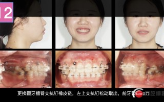 ai矫正边，ai如何矫正图片